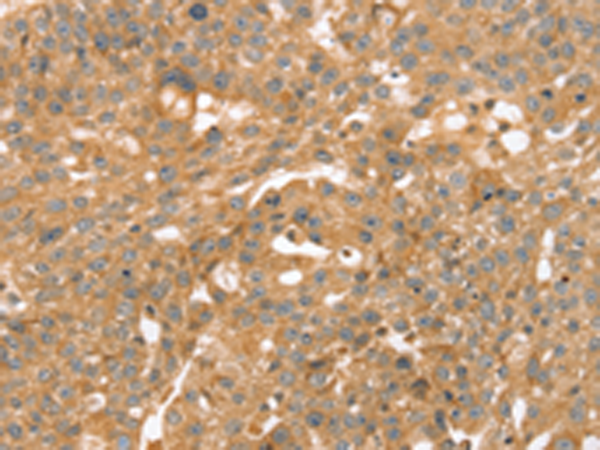 Rabbit Polyclonal Antibody to TRIM45
