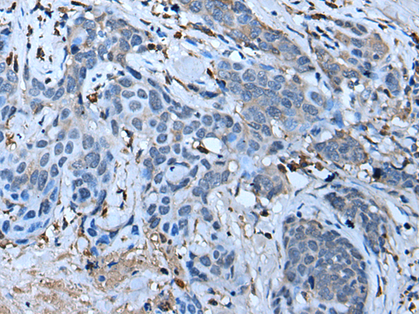 Rabbit Polyclonal Antibody to F3
