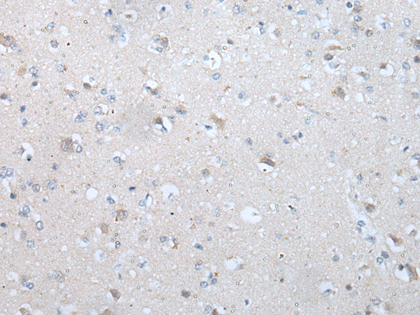 Rabbit Polyclonal Antibody to TM9SF1