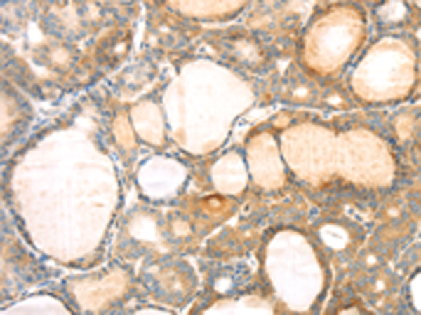 Rabbit Polyclonal Antibody to EVA1A