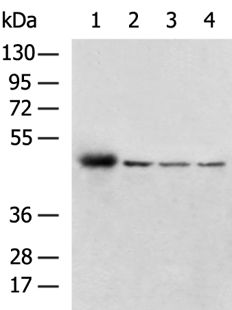 Rabbit Polyclonal Antibody to VMP1