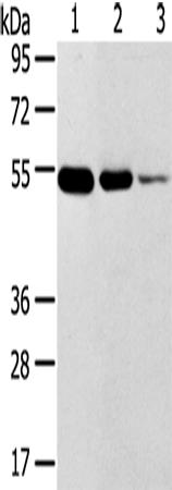Rabbit Polyclonal Antibody to TMPRSS11F
