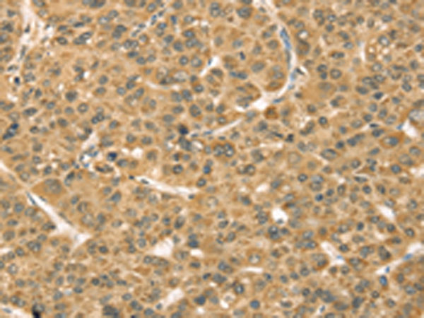 Rabbit Polyclonal Antibody to TMPRSS3