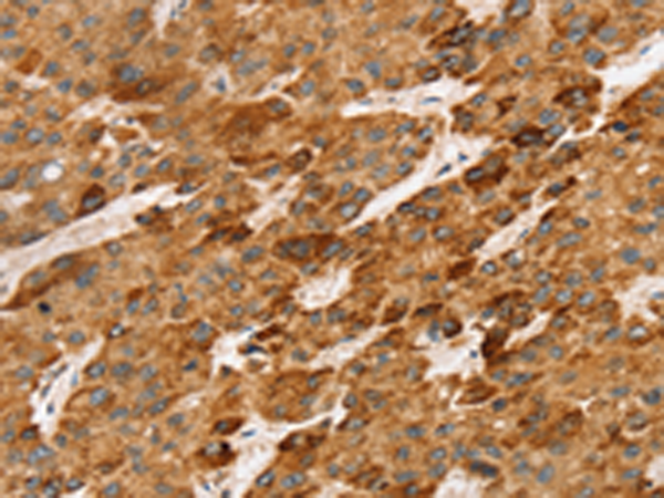 Rabbit Polyclonal Antibody to LTB