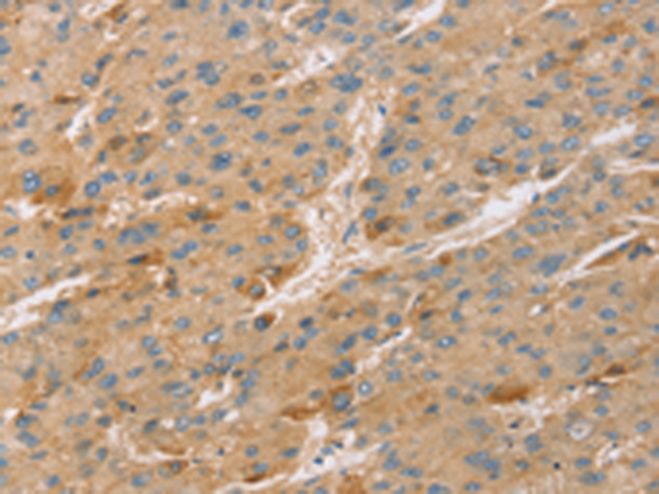 Rabbit Polyclonal Antibody to TNFSF13