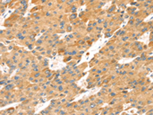 Rabbit Polyclonal Antibody to TNFSF15
