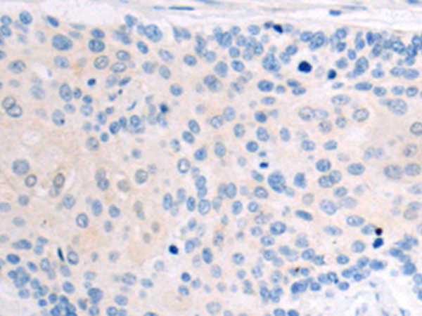 Rabbit Polyclonal Antibody to TNFSF18
