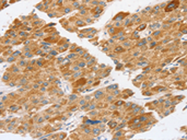 Rabbit Polyclonal Antibody to TP53I11