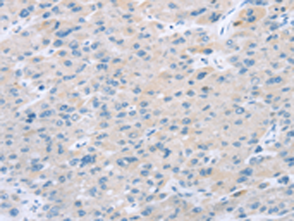 Rabbit Polyclonal Antibody to EI24