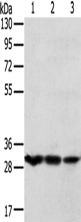 Rabbit Polyclonal Antibody to TPD52L2