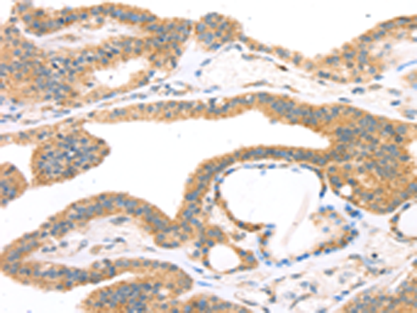 Rabbit Polyclonal Antibody to TPH2