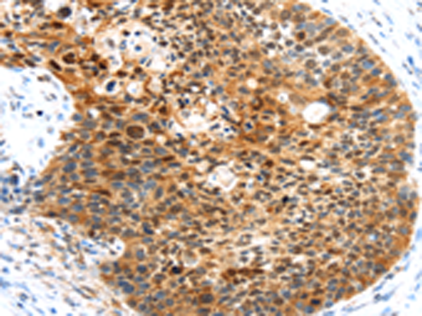 Rabbit Polyclonal Antibody to HUNK