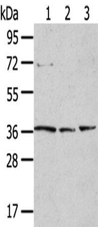 Rabbit Polyclonal Antibody to TPST1