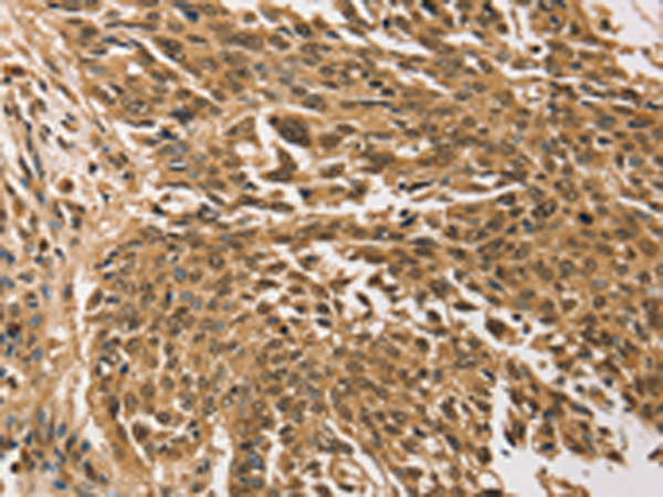 Rabbit Polyclonal Antibody to TGM7