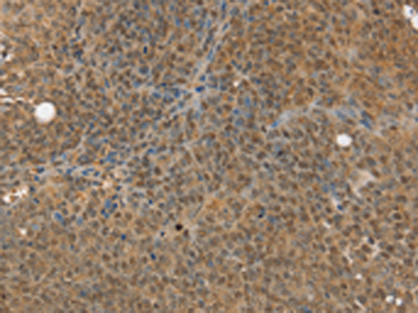 Rabbit Polyclonal Antibody to MED12