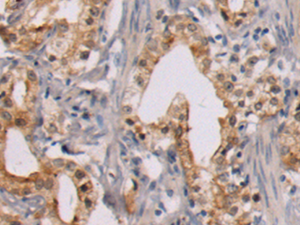 Rabbit Polyclonal Antibody to MED13