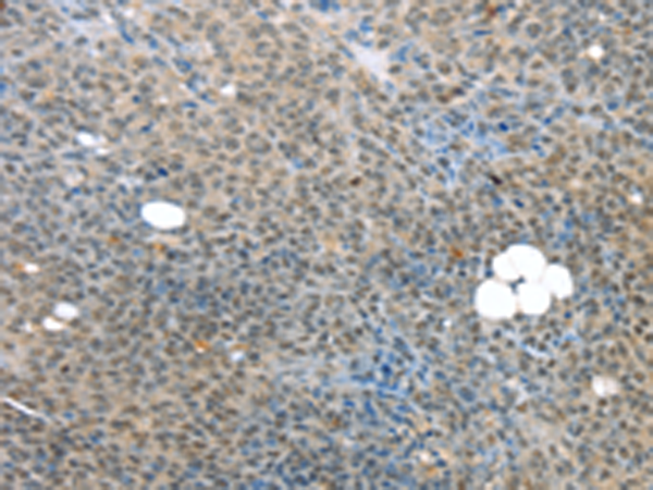Rabbit Polyclonal Antibody to MED15