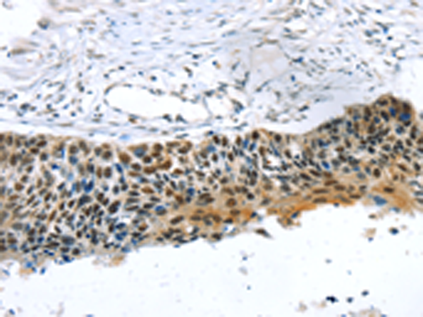 Rabbit Polyclonal Antibody to TRERF1