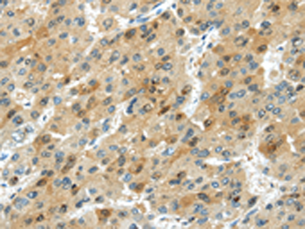 Rabbit Polyclonal Antibody to TRIB1