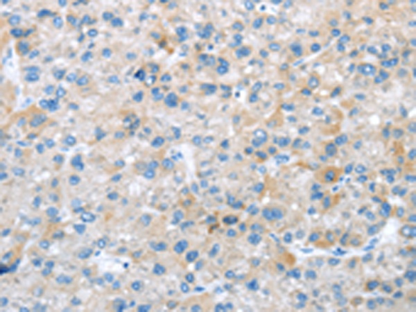 Rabbit Polyclonal Antibody to TRIM47