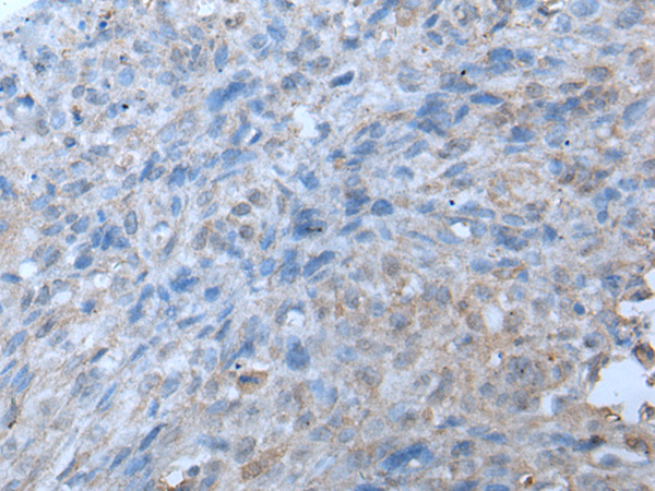 Rabbit Polyclonal Antibody to TRIP11