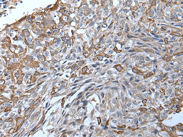 Rabbit Polyclonal Antibody to TRPC5