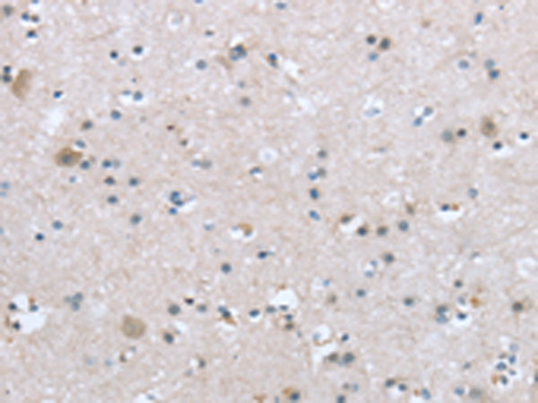 Rabbit Polyclonal Antibody to TRPM3