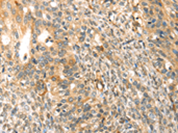 Rabbit Polyclonal Antibody to TRPV3
