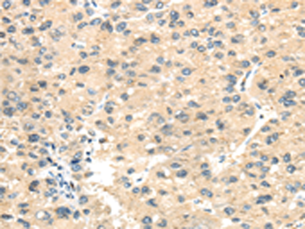 Rabbit Polyclonal Antibody to THBS1