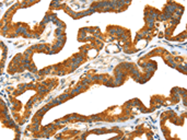 Rabbit Polyclonal Antibody to PRSS50