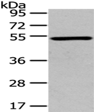 Rabbit Polyclonal Antibody to TSPYL1