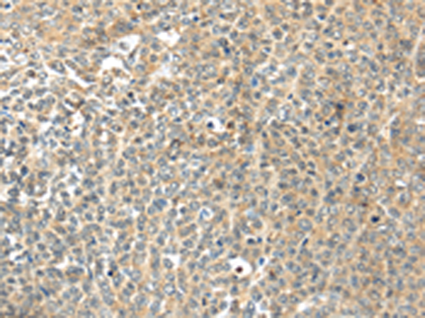 Rabbit Polyclonal Antibody to TSPYL6