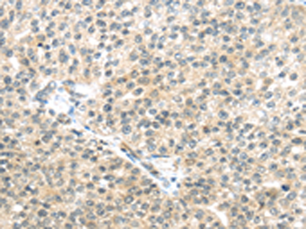 Rabbit Polyclonal Antibody to TTBK2