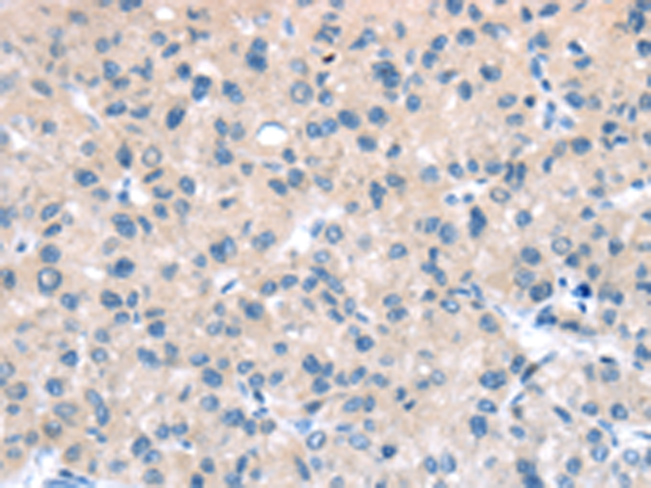 Rabbit Polyclonal Antibody to TTI1