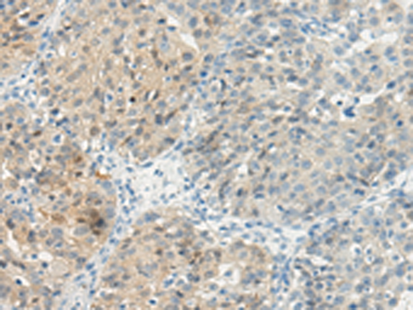 Rabbit Polyclonal Antibody to TBXA2R