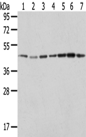 Rabbit Polyclonal Antibody to ERP44