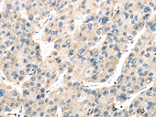 Rabbit Polyclonal Antibody to TXNIP