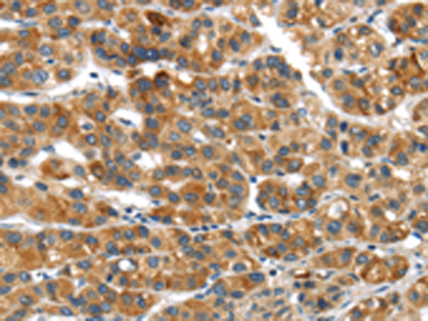 Rabbit Polyclonal Antibody to UBAP2