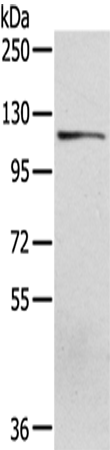 Rabbit Polyclonal Antibody to UBA1