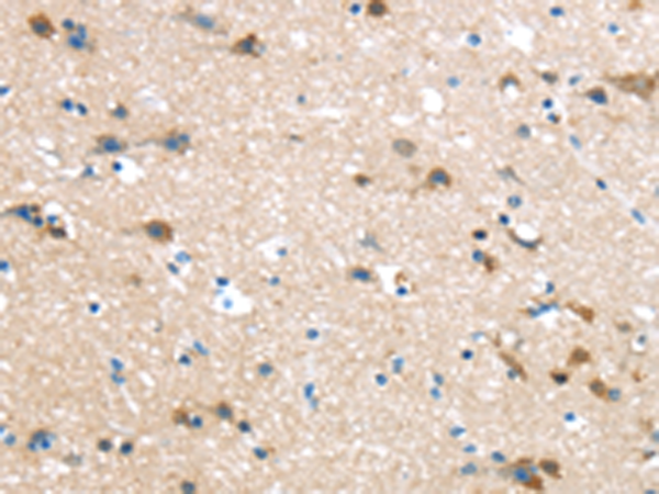 Rabbit Polyclonal Antibody to HAUS7