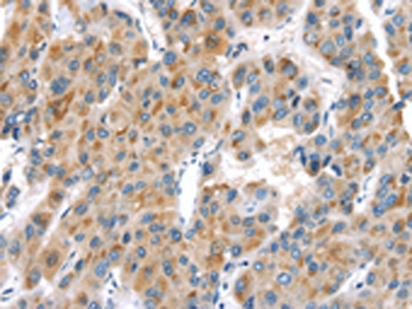 Rabbit Polyclonal Antibody to UCP2