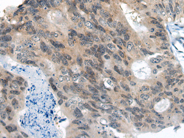 Rabbit Polyclonal Antibody to SLC25A27
