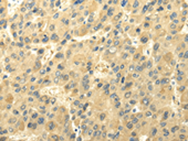 Rabbit Polyclonal Antibody to UGT1A6