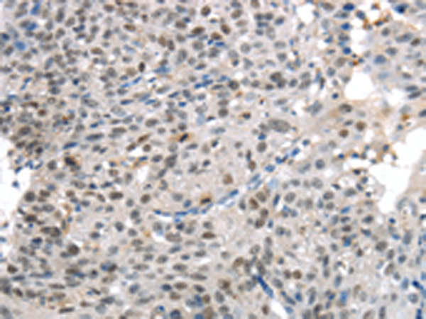 Rabbit Polyclonal Antibody to KDM5C