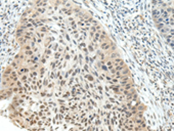 Rabbit Polyclonal Antibody to NSD1