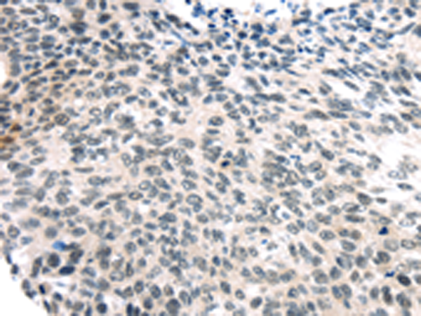 Rabbit Polyclonal Antibody to USP7