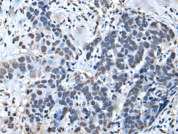 Rabbit Polyclonal Antibody to GTF2H1
