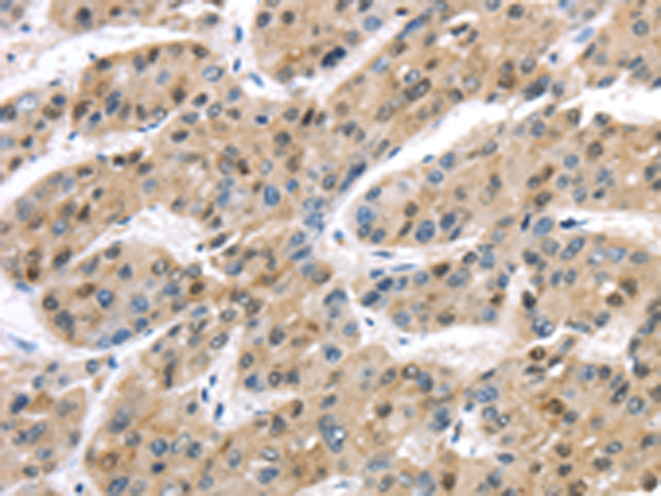 Rabbit Polyclonal Antibody to TAB1