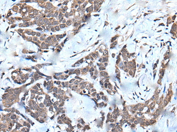 Rabbit Polyclonal Antibody to HNRNPU