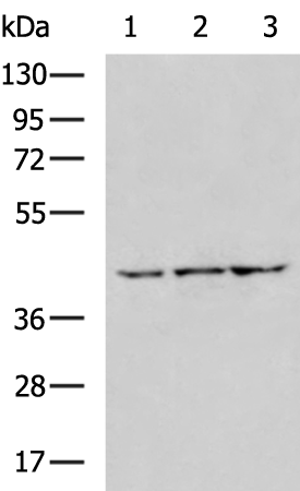 Rabbit Polyclonal Antibody to UPP2
